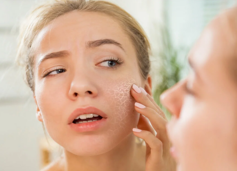 14 reglas para el cuidado de la piel que debes seguir si tienes la piel seca