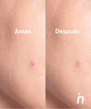 Nipskin Accesorios Nipskin Spot Me Here Parches para Imperfecciones SK000