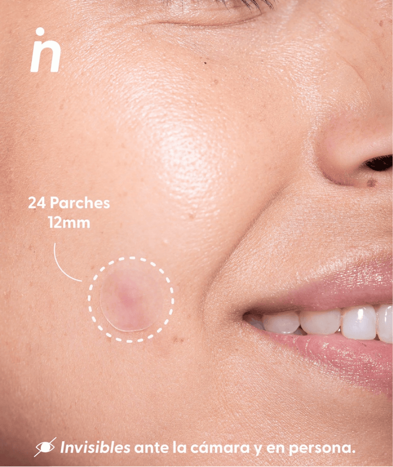 Nipskin Accesorios Nipskin Spot Me Here Parches para Imperfecciones SK000